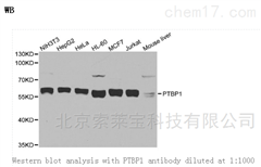 K000419PAnti-PTBP1 Polyclonal Antibody