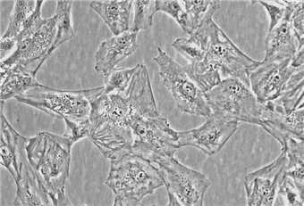 HVT；人絨毛膜滋養層細胞（原代細胞）
