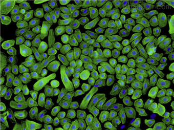 HEK；人新生兒表皮角質細胞（原代細胞）